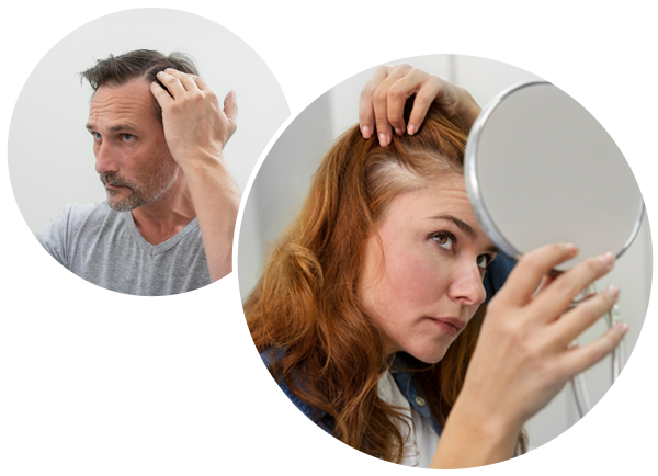 Hair Concerns